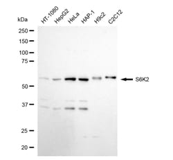 Invitrogen RPS6KB2 Recombinant Rabbit Monoclonal Antibody (24GB5075):Antibodies:Primary