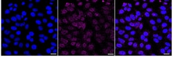 Invitrogen SR-BI Recombinant Rabbit Monoclonal Antibody (24GB1395) 20 &mu;L;
