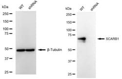 Invitrogen SR-BI Recombinant Rabbit Monoclonal Antibody (24GB1395):Antibodies:Primary