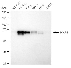 Invitrogen SR-BI Recombinant Rabbit Monoclonal Antibody (24GB1395) 20 &mu;L;