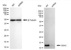 Invitrogen SDHC Recombinant Rabbit Monoclonal Antibody (24GB1075) 20 &mu;L;