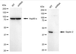 Invitrogen Septin 2 Recombinant Rabbit Monoclonal Antibody (24GB1525) 20