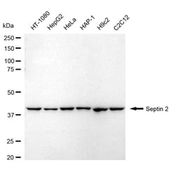 Invitrogen Septin 2 Recombinant Rabbit Monoclonal Antibody (24GB1525) 20
