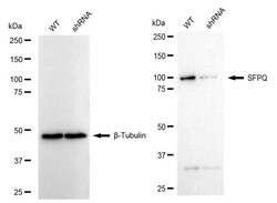 Invitrogen SFPQ Recombinant Rabbit Monoclonal Antibody (24GB1220) 20 &mu;L;