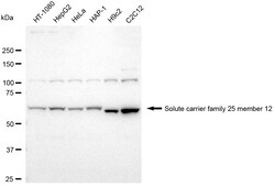 Invitrogen SLC25A12 Recombinant Rabbit Monoclonal Antibody (24GB2340) 100