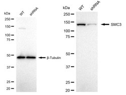 Invitrogen SMC3 Recombinant Rabbit Monoclonal Antibody (24GB2155):Antibodies:Primary