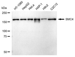 Invitrogen SMC4 Recombinant Rabbit Monoclonal Antibody (24GB2400) 100 &mu;L;