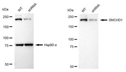 Invitrogen SMCHD1 Recombinant Rabbit Monoclonal Antibody (24GB2385) 20