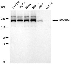 Invitrogen SMCHD1 Recombinant Rabbit Monoclonal Antibody (24GB2385) 20