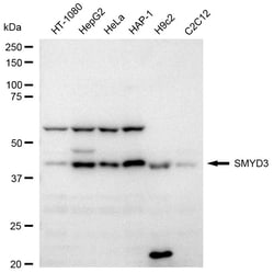Invitrogen SMYD3 Recombinant Rabbit Monoclonal Antibody (24GB2260):Antibodies,