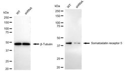 Invitrogen SSTR5 Recombinant Rabbit Monoclonal Antibody (24GB2600):Antibodies:Primary