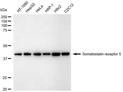 Invitrogen SSTR5 Recombinant Rabbit Monoclonal Antibody (24GB2600):Antibodies:Primary