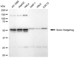 Invitrogen SHH Recombinant Rabbit Monoclonal Antibody (24GB1925):Antibodies:Primary