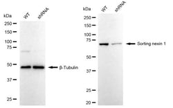Invitrogen SNX1 Recombinant Rabbit Monoclonal Antibody (24GB2595) 100 &mu;L;