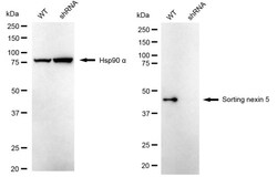 Invitrogen SNX5 Recombinant Rabbit Monoclonal Antibody (24GB2310):Antibodies:Primary