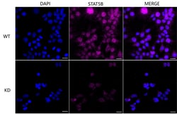 Invitrogen STAT5 beta Recombinant Rabbit Monoclonal Antibody (24GB2110)