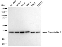 Invitrogen STOML2 Recombinant Rabbit Monoclonal Antibody (24GB1870) 100