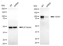 Invitrogen UNC84A Recombinant Rabbit Monoclonal Antibody (24GB2575) 100