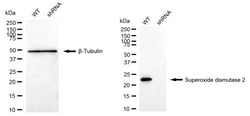 Invitrogen SOD2 Recombinant Rabbit Monoclonal Antibody (24GB2135):Antibodies,
