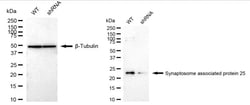 Invitrogen SNAP25 Recombinant Rabbit Monoclonal Antibody (24GB2640):Antibodies:Primary
