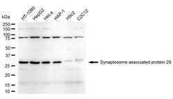 Invitrogen SNAP29 Recombinant Rabbit Monoclonal Antibody (24GB1855) 20