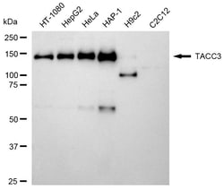 Invitrogen TACC3 Recombinant Rabbit Monoclonal Antibody (24GB1940) 20 &mu;L;