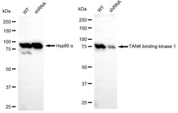Invitrogen TBK1 Recombinant Rabbit Monoclonal Antibody (24GB4640):Antibodies,