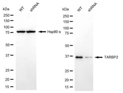 Invitrogen TRBP Recombinant Rabbit Monoclonal Antibody (24GB2425):Antibodies,