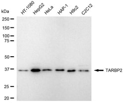 Invitrogen TRBP Recombinant Rabbit Monoclonal Antibody (24GB2425):Antibodies,
