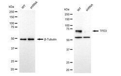 Invitrogen TFE3 Recombinant Rabbit Monoclonal Antibody (24GB2630) 20 &mu;L;