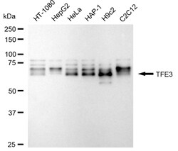 Invitrogen TFE3 Recombinant Rabbit Monoclonal Antibody (24GB2630) 20 &mu;L;