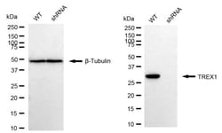 Invitrogen TREX1 Recombinant Rabbit Monoclonal Antibody (24GB2440):Antibodies:Primary