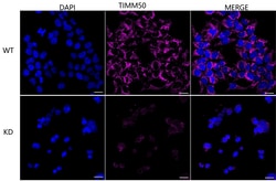 Invitrogen TIMM50 Recombinant Rabbit Monoclonal Antibody (24GB2670) 100