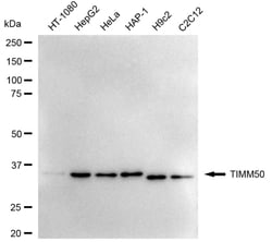 Invitrogen TIMM50 Recombinant Rabbit Monoclonal Antibody (24GB5300) 100