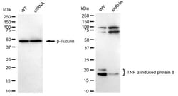 Invitrogen TNFAIP8 Recombinant Rabbit Monoclonal Antibody (24GB2315):Antibodies:Primary