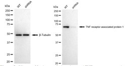 Invitrogen TRAP1 Recombinant Rabbit Monoclonal Antibody (24GB2560) 20 &mu;L;
