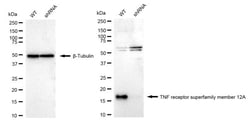 Invitrogen CD266 Recombinant Rabbit Monoclonal Antibody (24GB2070) 100