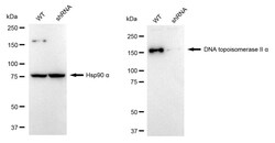 Invitrogen TOP2A Recombinant Rabbit Monoclonal Antibody (24GB1915) 100