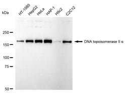 Invitrogen TOP2A Recombinant Rabbit Monoclonal Antibody (24GB1915):Antibodies:Primary