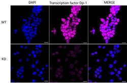 Invitrogen DP1 Recombinant Rabbit Monoclonal Antibody (24GB2685) 100 &mu;L;