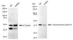 Invitrogen TMEM43 Recombinant Rabbit Monoclonal Antibody (24GB2325) 100
