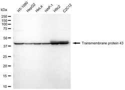 Invitrogen TMEM43 Recombinant Rabbit Monoclonal Antibody (24GB2325) 100