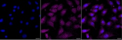 Invitrogen TPP2 Recombinant Rabbit Monoclonal Antibody (24GB2015) 20 &mu;L;