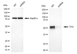 Invitrogen TRK fused gene Recombinant Rabbit Monoclonal Antibody (24GB2115):Antibodies:Primary