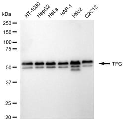 Invitrogen TRK fused gene Recombinant Rabbit Monoclonal Antibody (24GB2115):Antibodies:Primary