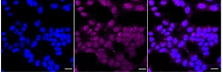 Invitrogen 5T4 Recombinant Rabbit Monoclonal Antibody (24GB1990):Antibodies:Primary