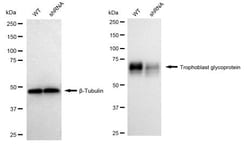 Invitrogen 5T4 Recombinant Rabbit Monoclonal Antibody (24GB2035):Antibodies,