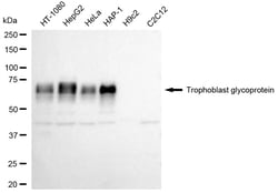 Invitrogen 5T4 Recombinant Rabbit Monoclonal Antibody (24GB2035):Antibodies:Primary