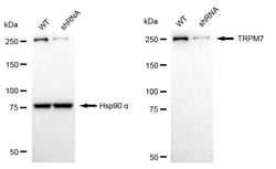 Invitrogen TRPM7 Recombinant Rabbit Monoclonal Antibody (24GB2250) 100