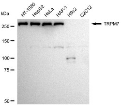 Invitrogen TRPM7 Recombinant Rabbit Monoclonal Antibody (24GB2250) 100
